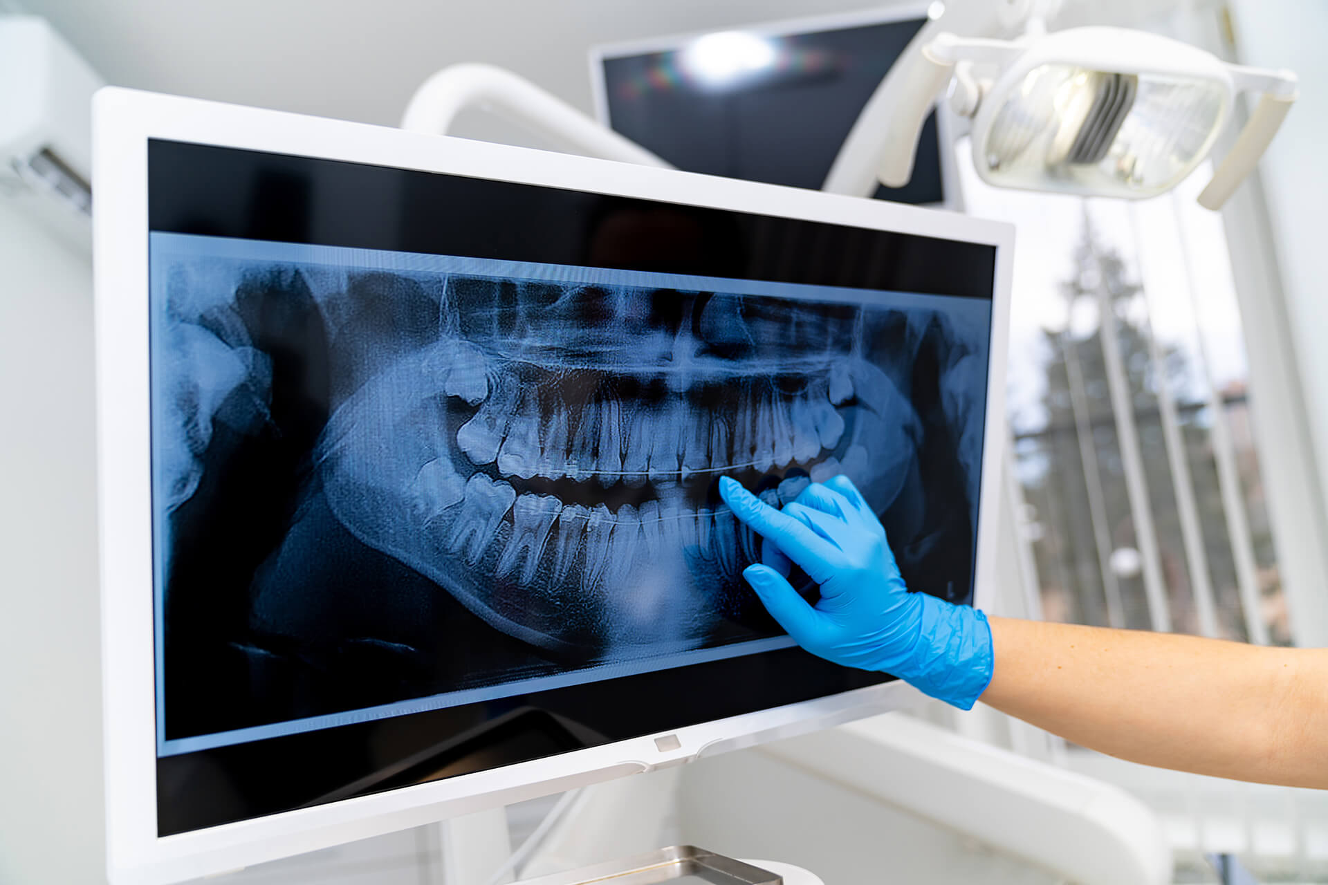 Dentist reviewing dental x-ray on computer screen while wearing a blue glove.